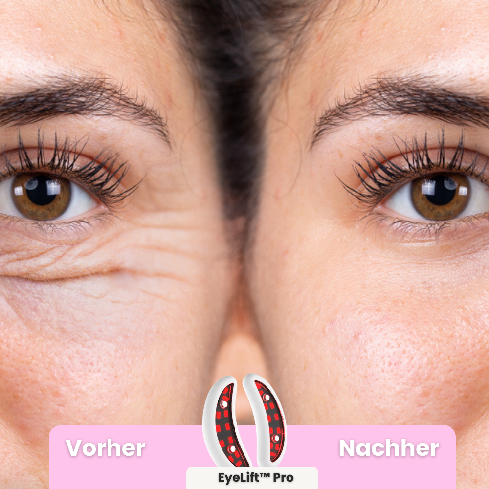 EyeLift™ Pro