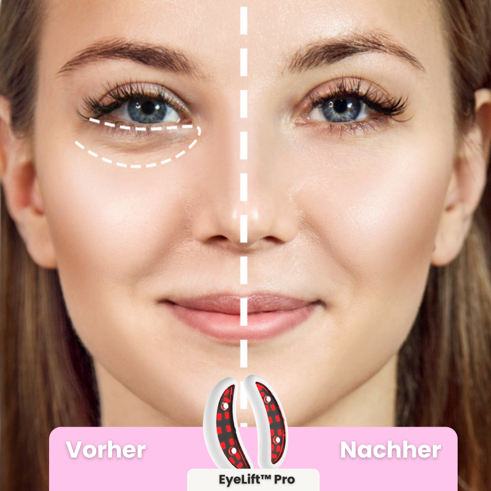 EyeLift™ Pro